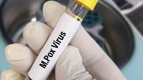 La crisis de mpox en África crece con 4.000 nuevos casos en una semana. El Congo, epicentro del brote, enfrenta demoras en la llegada de vacunas.