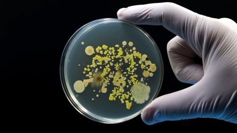 Reportan dos muertos por brote de listeria en Estados Unidos